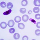 Malaria parasites under the microscope